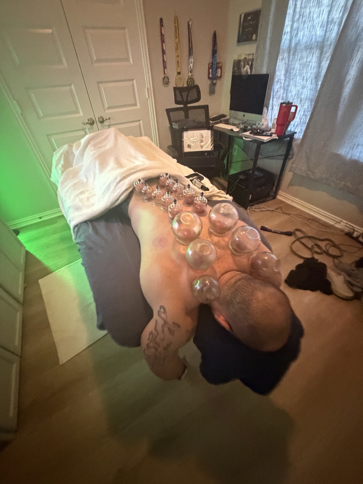Therapeutic cupping session