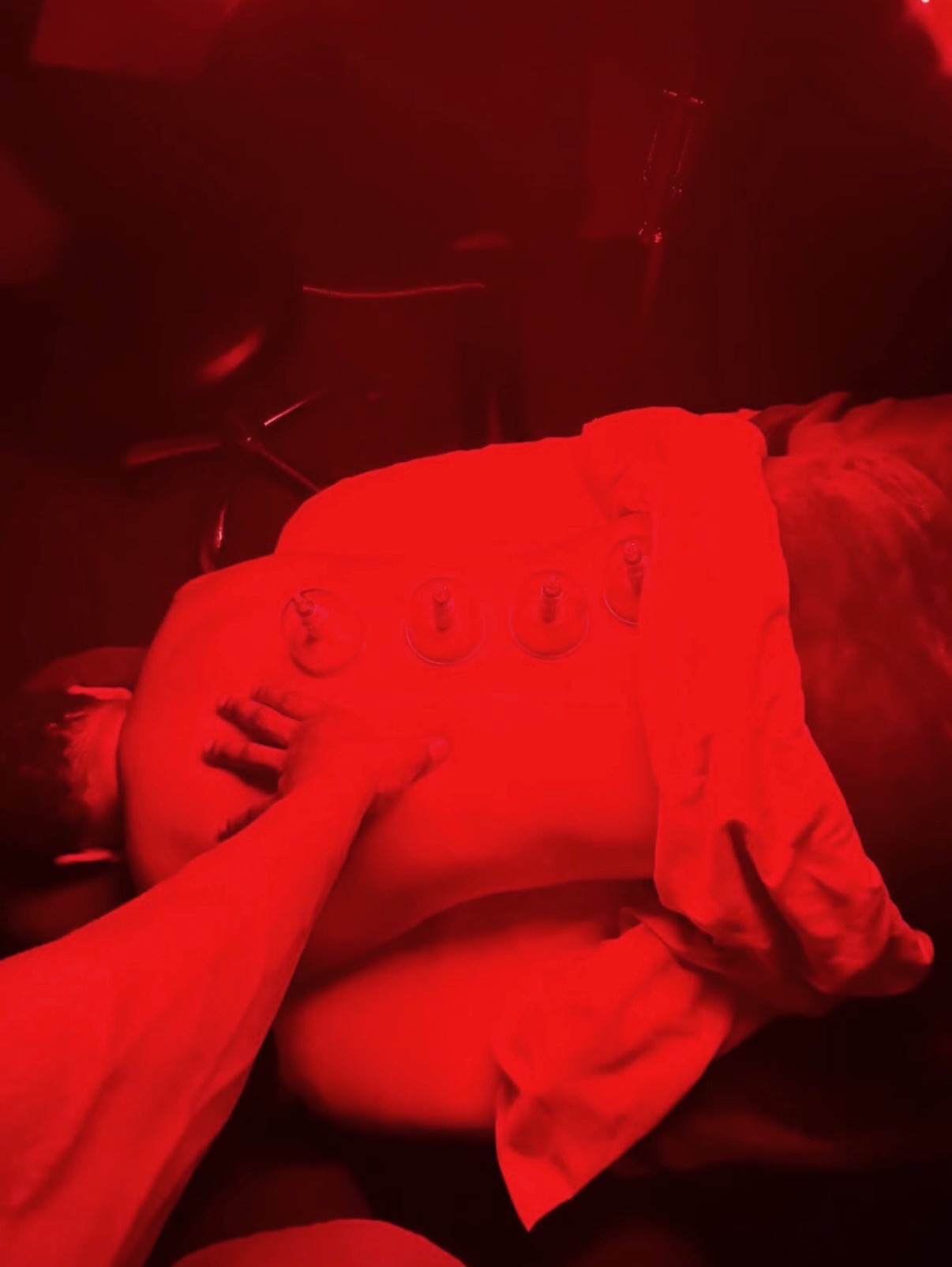 Red light therapy with cupping